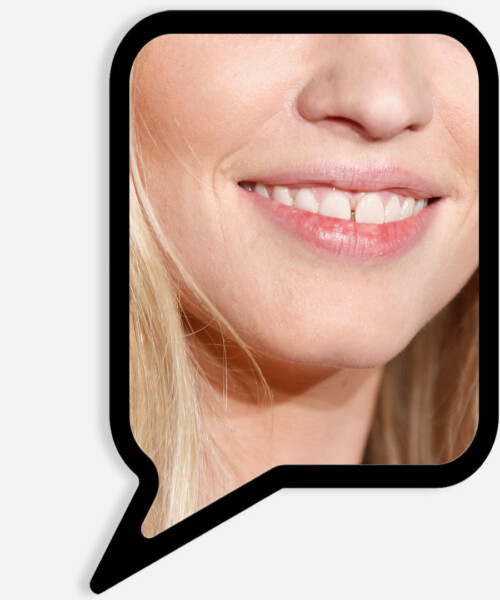 Body Language: All About Teeth